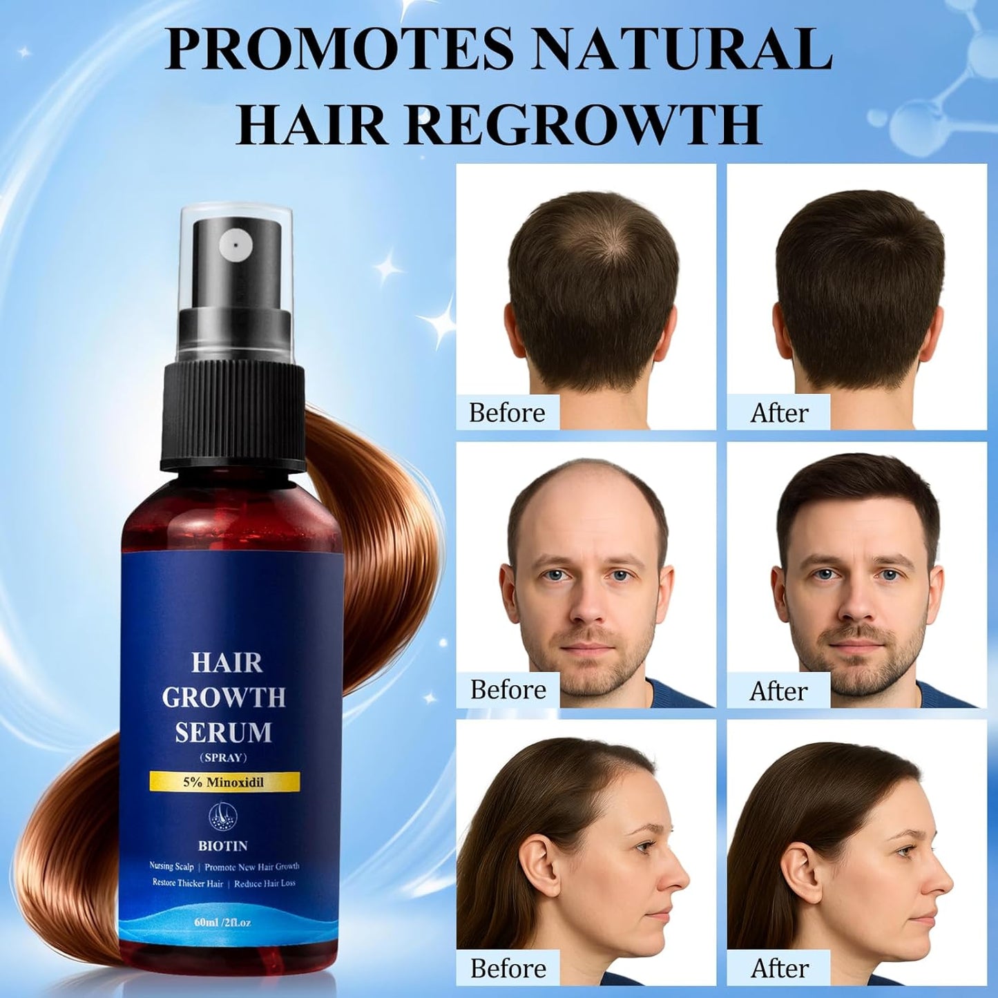 5% Minoxidil Hair Growth Spray - 3PCS Minoxidil for Women Hair Growth, Minoxidil for Men Hair and Beard, Hair Loss Treatment to Reduce Thinning & Regrow Hair (60ml*3 Pack)