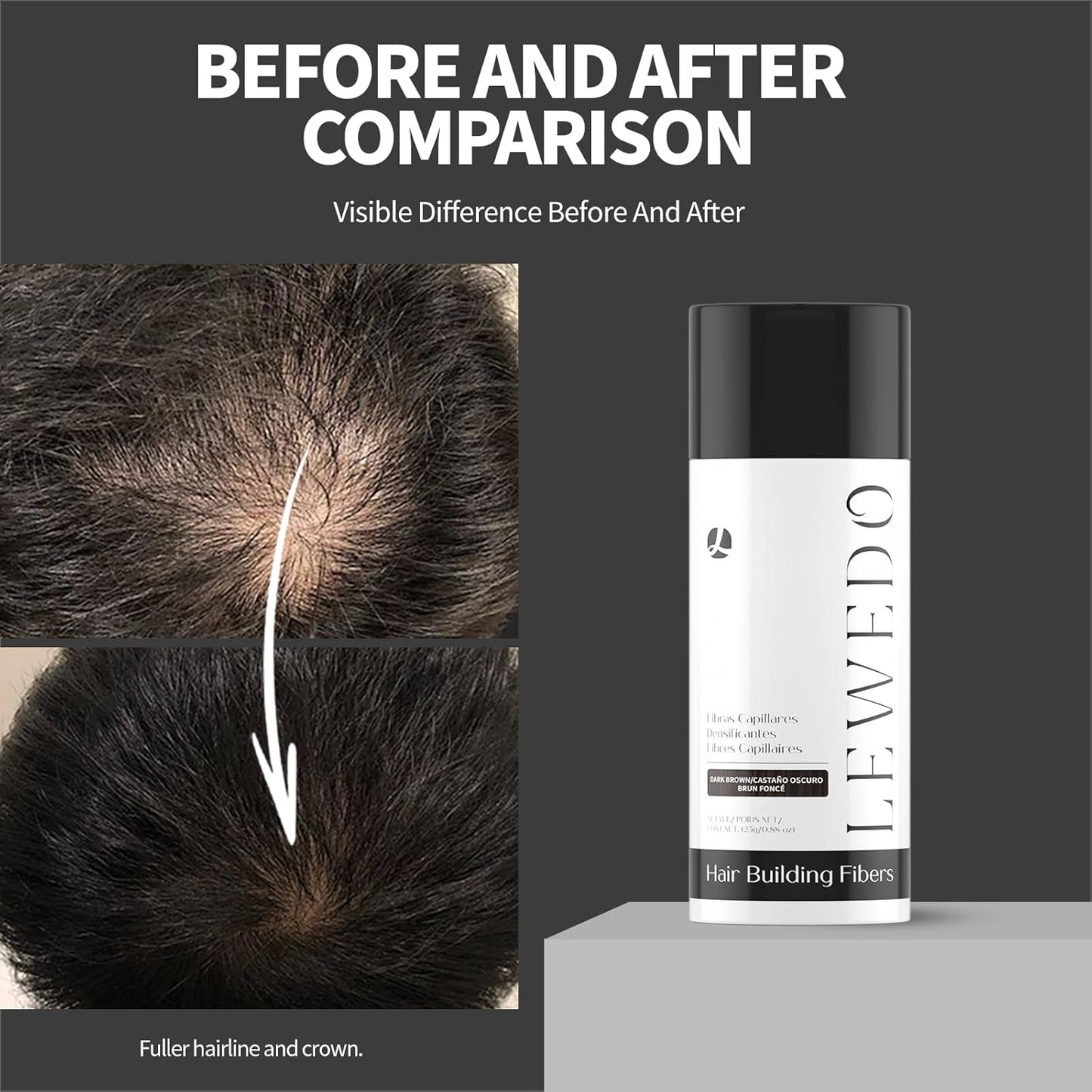 Hair Building Fibers 25G with Precision Spray Applicator - Electrostatic Adsorption for Instant Thicker Hair, Waterproof & Natural Look, Suitable for Men & Women (Black)
