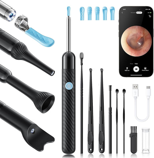 Loyker X6 Ear Wax Removal Tool Camera, Ear Cleaner with Camera, FSA - HSA Store Eligible, 1080P Ear Camera with 6LED Light for Ear/Nose/Throat/Tonsil Stone Examination, Black