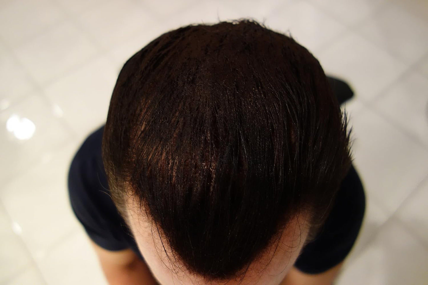 Hair Building Fibers 50 Grams Refill Your Existing Bottle. Highest Grade Fiber By Finally Hair (Medium Salt & Pepper - Dark Chocolate Brown with Touch of White Special Formula)